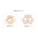 骨盤のゆがみ