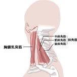 胸鎖乳突筋