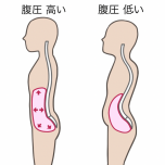 腹圧