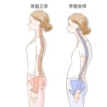 骨盤の後傾