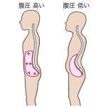 腹圧