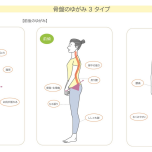 骨盤の歪み