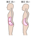 腹圧