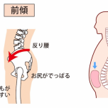 反り腰