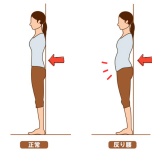 反り腰チェック